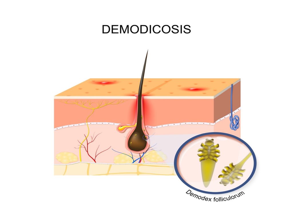 Demodex Milben Demodikose Erkennen und Behandeln