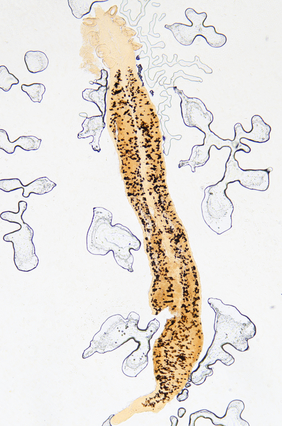 Hakenwurm unter dem Mikroskop